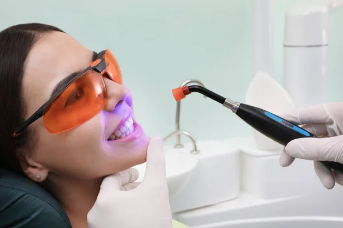 The Benefits of Laser Cavity Removal and Tooth Preparation