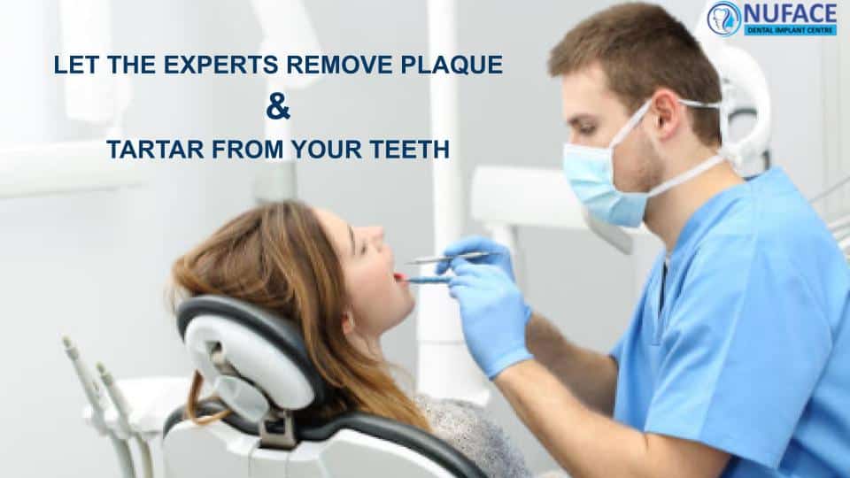 Let the experts remove dental plaque and tartar from your teeth